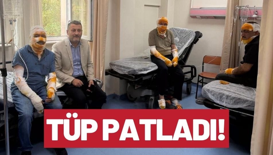 Tüp Patladı: 3 Yaralı, Başkan Koçyiğit Hastanede Ziyaret Etti